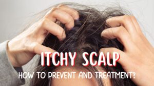 Itchy-Scalp-How-To-Prevent-And-Treatment