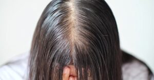 How-To-Fix-Oily-Hair-and-Other-Greasy-Hair-Hacks