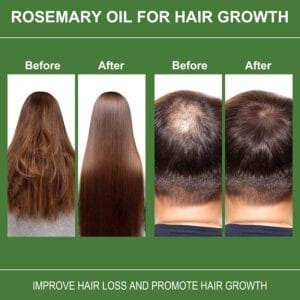 Rosemary-Oil-For-Hair-Secret-Treatment-Method-For-A-Shiny-Healthy-Hair