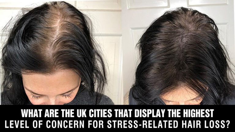 What-Are-The-UK-Cities-That-Display-The-Highest-Level-of-Concern-For-Stress-Related-Hair-Loss