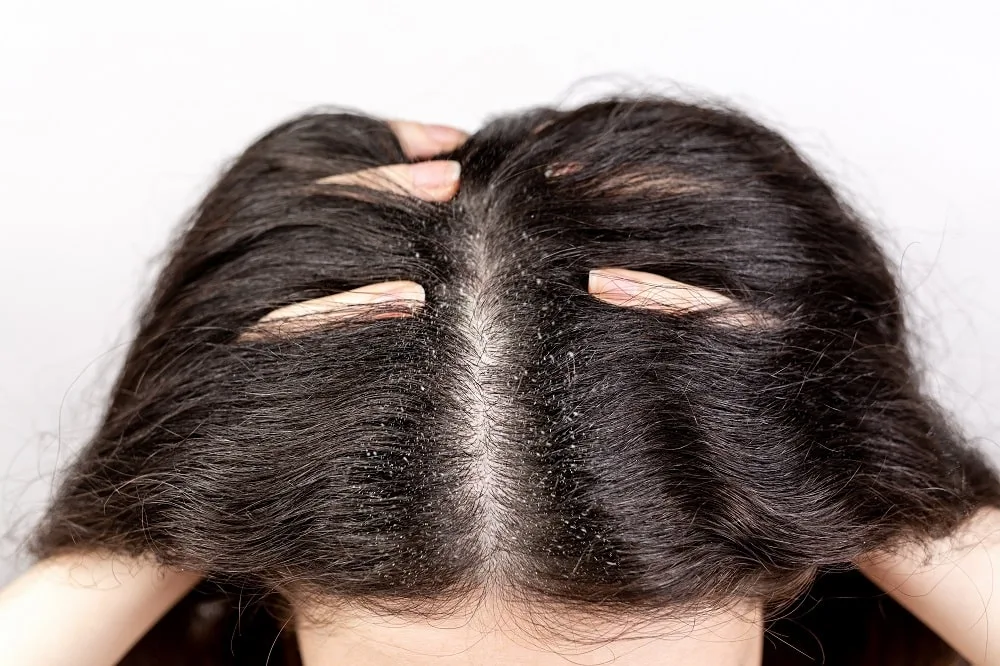 How-To-Care-For-Your-Scalp-At-Home