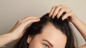 Biotin-For-Hair-Growth-The-Key-to-Radiant-Hair-You've-Been-Missing