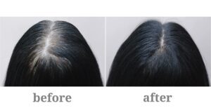 Biotin-For-Hair-Growth-The-Key-to-Radiant-Hair-You've-Been-Missing