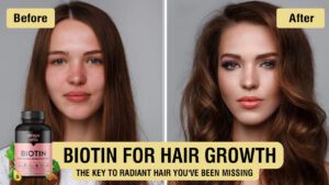 Biotin-For-Hair-Growth-The-Key-to-Radiant-Hair-You've-Been-Missing