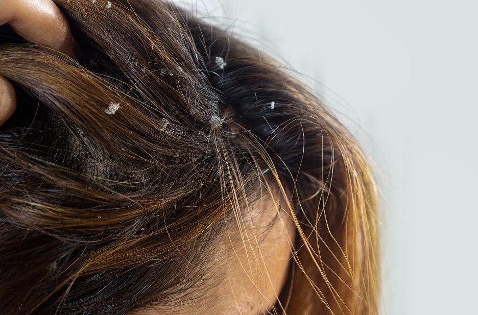 How-Does-Hard-Water-Affect-Your-Hair