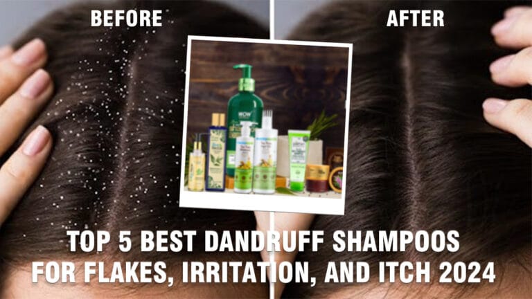 Top-5-Best-Dandruff-Shampoos-for-Flakes-Irritation-and-Itch-2024