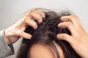 Are-Your-Hair-Extensions-Causing-Itchy-Scalp