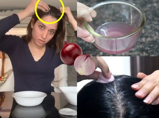 Onion-Juice-For-Hair-Can-It-Stop-Hair-Loss?