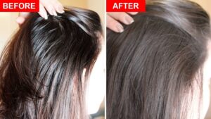 Effective-Tips-To-Get-Rid-of-Oily-Scalp-2024