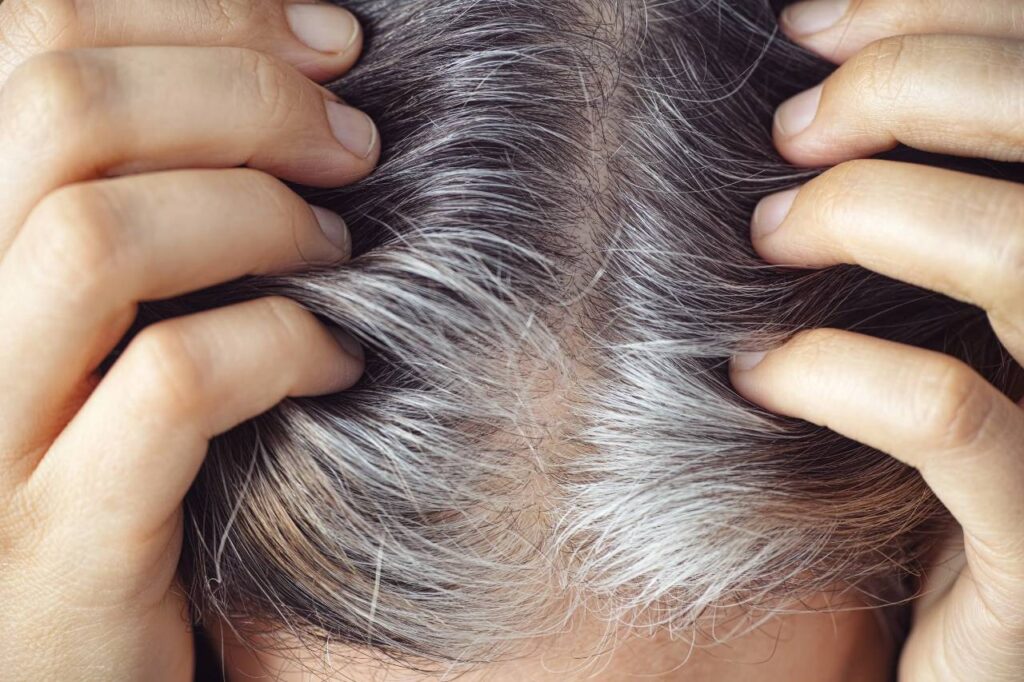 Why-Does-Hair-Turn-Gray