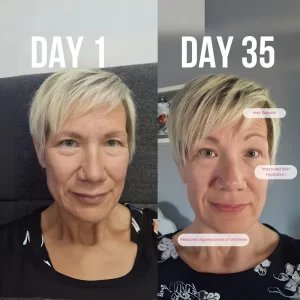 Revealing-Hair-Secrets-Whether-Collagen-Works-for-Hair-Growth-or-Not