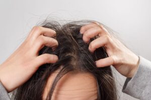 How-To-Deal-With-Sensitive-Scalp