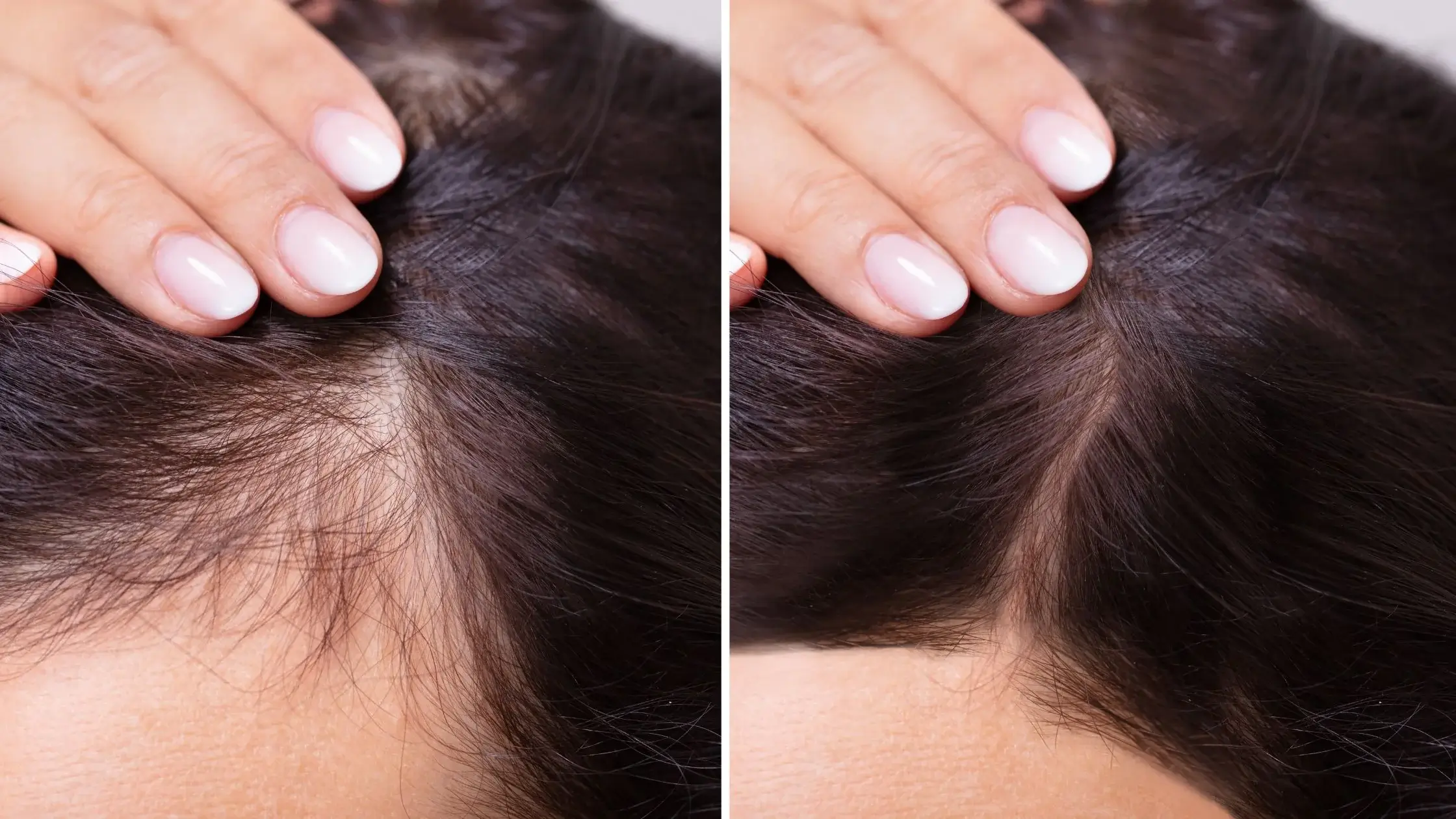 Prevent-Hair-Thinning-Ultimate-Guide-to-Lush-Voluminous-Hair